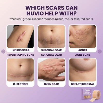 Nuvio Silicone Scar Sheets