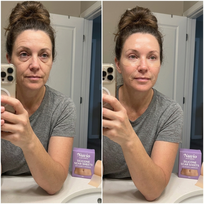 Nuvio Silicone Scar Sheets